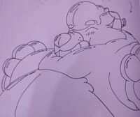 P-Balloon bloat (2/2)
