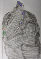 Xaier is stuck by Big giant Fat otnal the Plessie