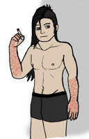 Jack's scars