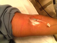 intravenous drip for me